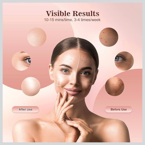 Inteo Red Light LED Therapy Facial Mask for Skin Rejuvenation - Picture 4 of 15